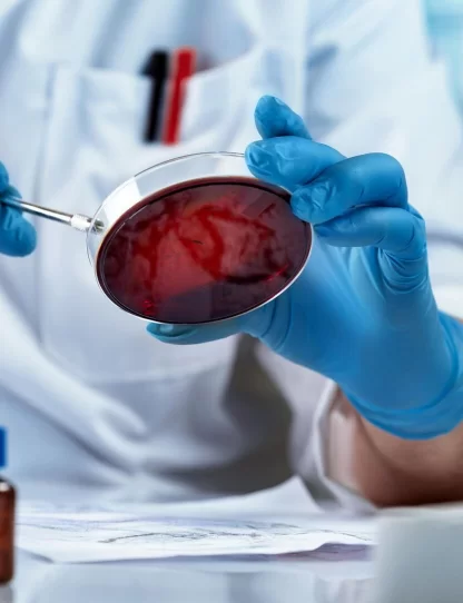 flash glucose monitoring system