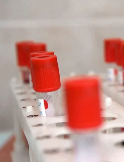 glucose monitor sinocare