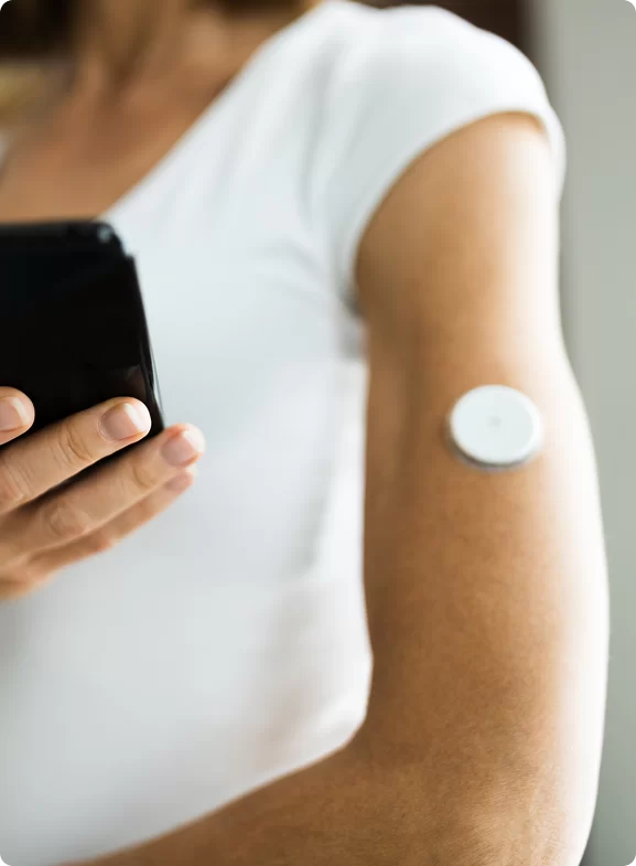 glucose continuous monitor