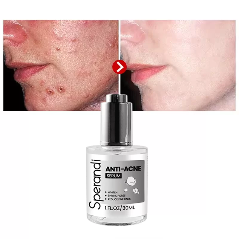 24K Gold Brightening Spot Removal Serum