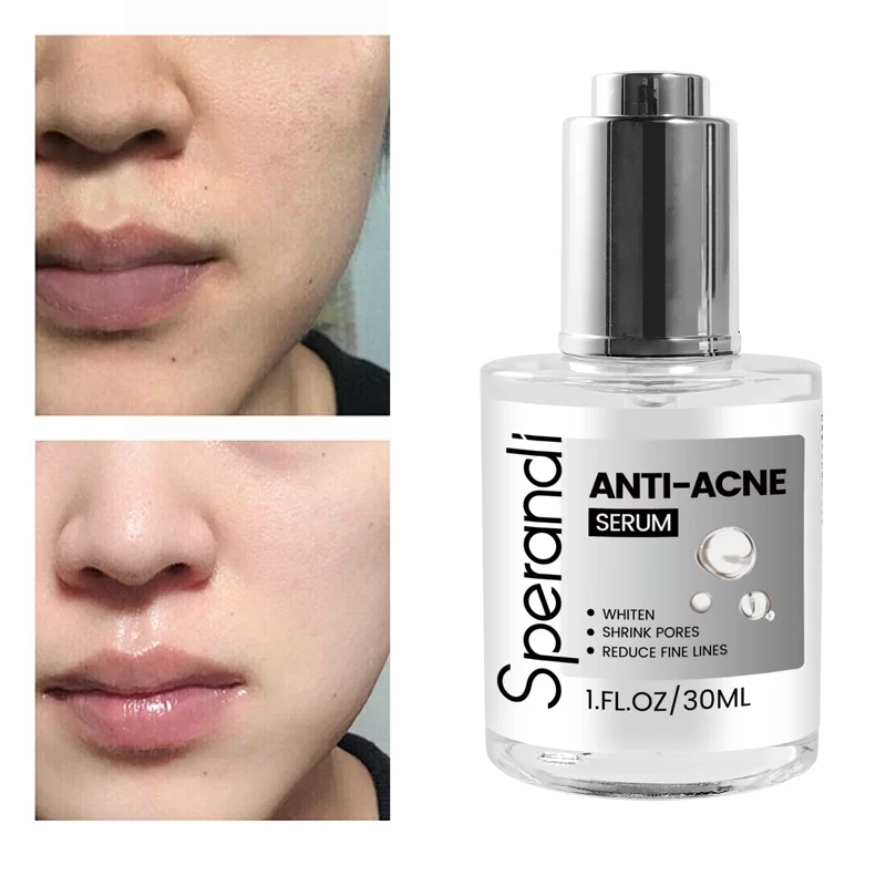 24K Gold Brightening Spot Removal Serum