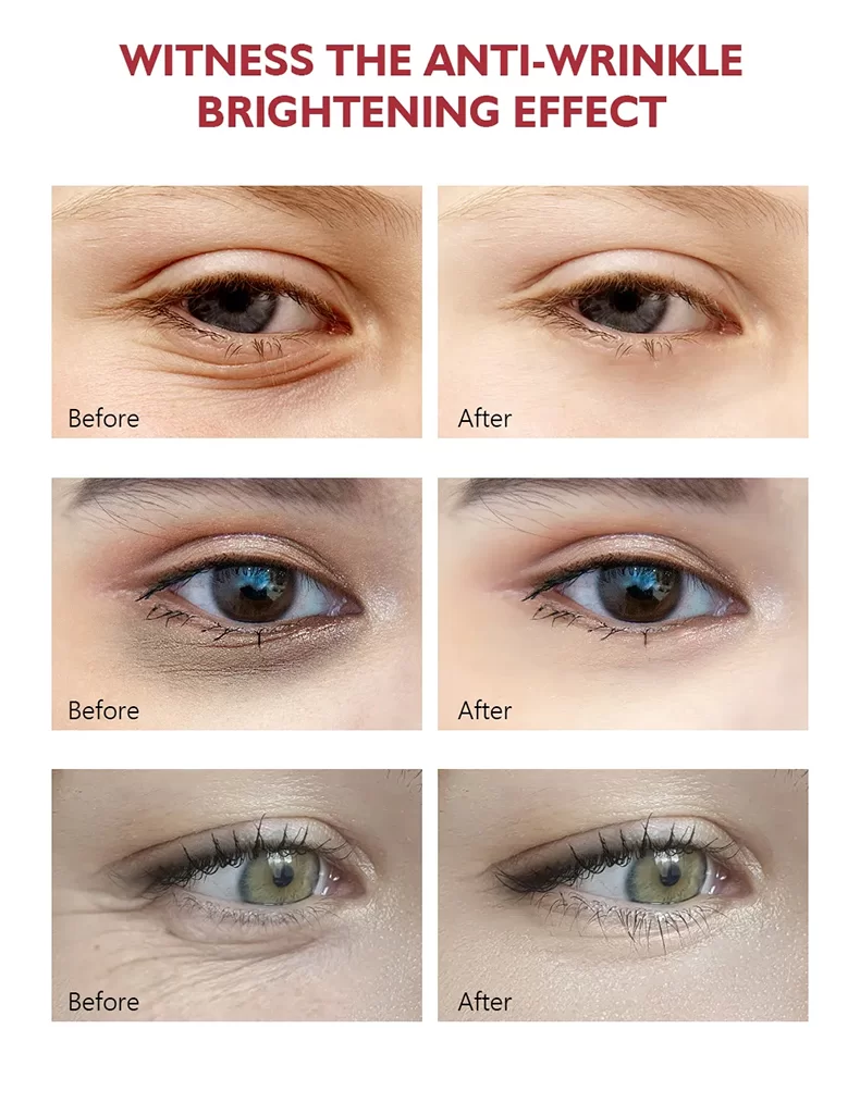 Hydrogel Eye Patches