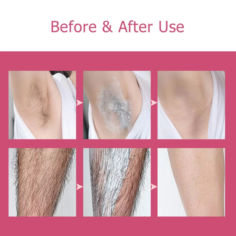 Gentle Painless Hair Removal Cream For All Skin Types