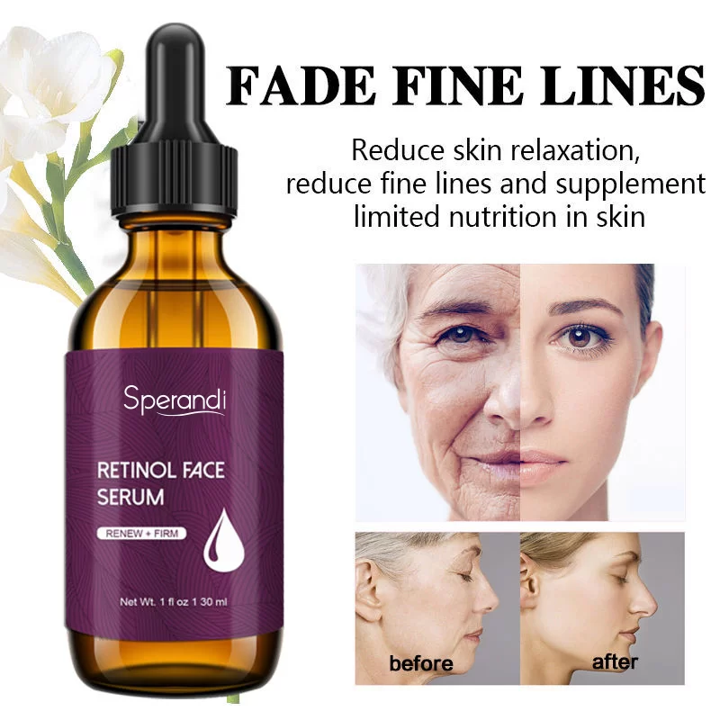 Retinol Anti-Wrinkle & Skin Renewal Serum – For Fine Lines, Wrinkles & Dull Skin