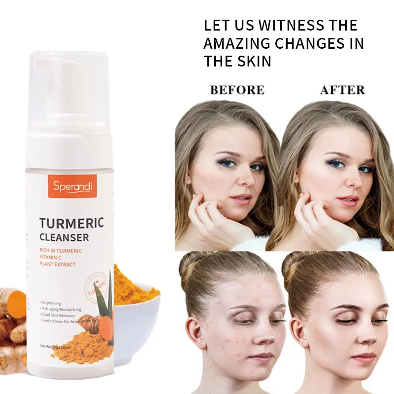 Turmeric Gentle Cleansing Mousse – Brightening & Oil-Control for All Skin Types