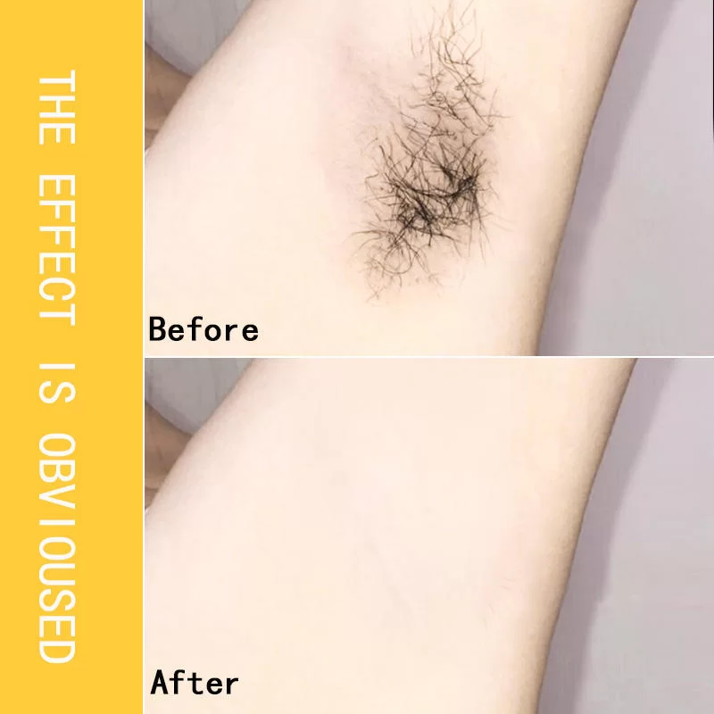 Gentle Painless Hair Removal Spray