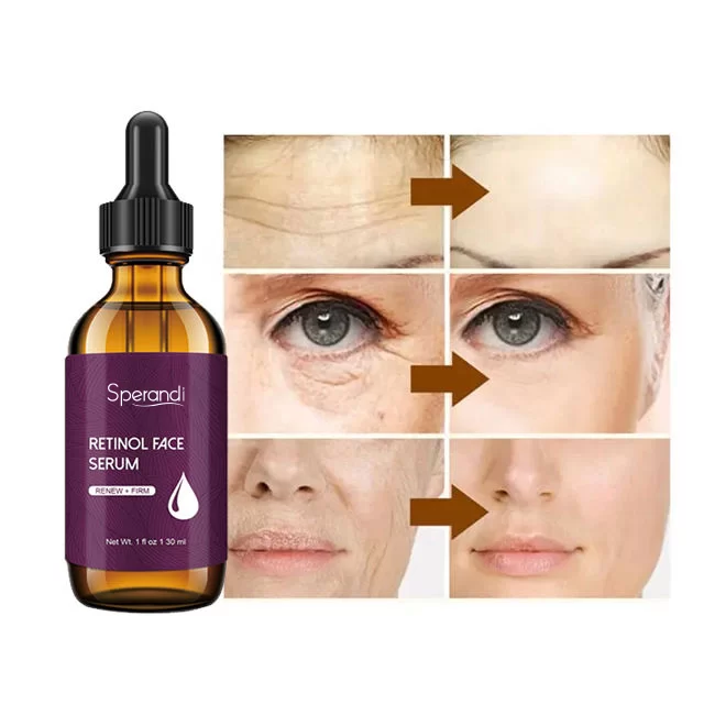 Retinol Anti-Wrinkle & Skin Renewal Serum – For Fine Lines, Wrinkles & Dull Skin