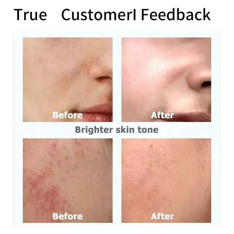 Glutathione Whitening Brightening Serum